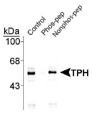 Western Blot: Tryptophan Hydroxylase 1/TPH-1 [p Ser260] Antibody [NB300-307]